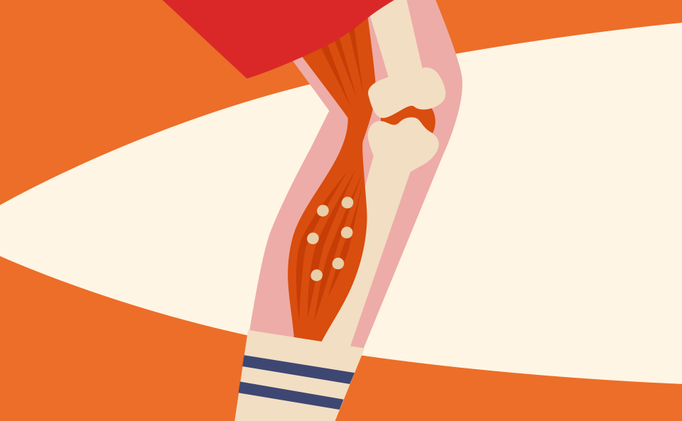 イメージ画像：フレイルと脂肪筋