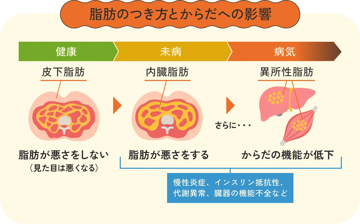 脂肪のつき方とからだへの影響：【健康】一番外側の皮下脂肪がついても脂肪は悪さをしない（見た目は悪くなる）、【未病】内臓の周りにつく内臓脂肪がつくと脂肪が悪さをする、【病気】体の中であふれ出て筋肉や内臓の中にたまる異所性脂肪がつくと体の機能が低下。未病と病気は慢性炎症、インスリン抵抗性、代謝異常、臓器の機能不全などが起こる